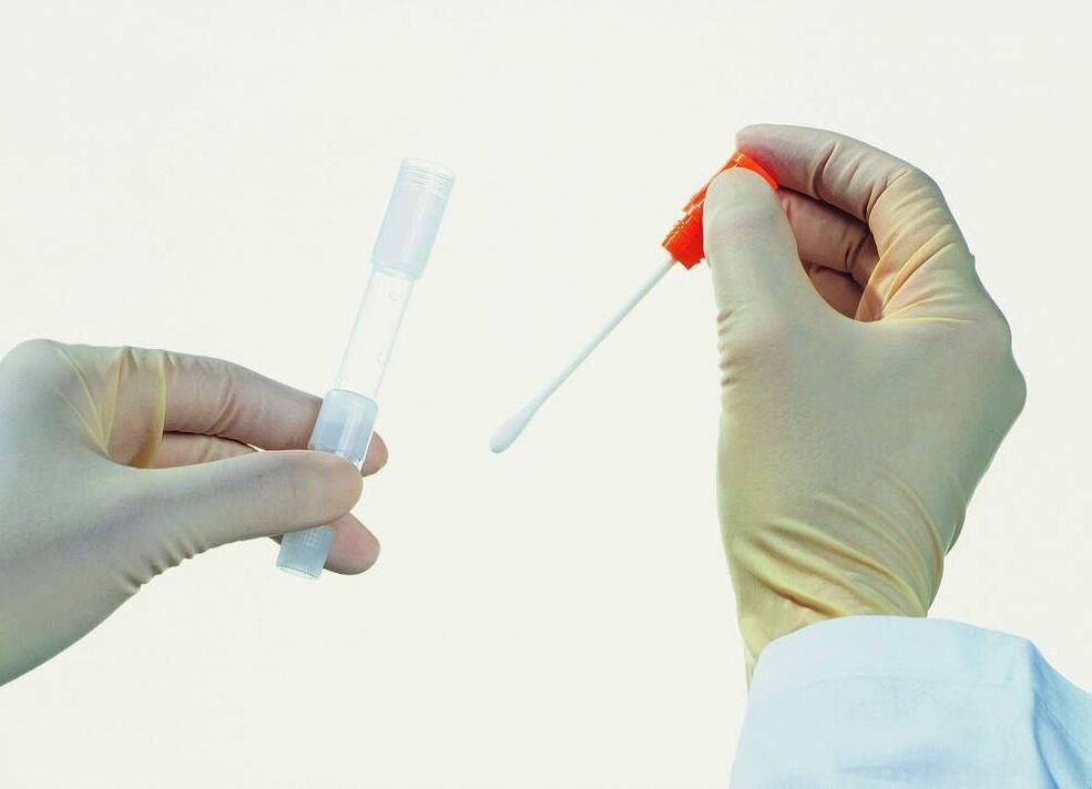 Recueillir des tests pour détecter la prostatite chronique